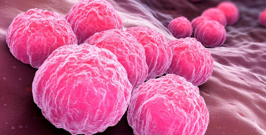Chlamydia Testing